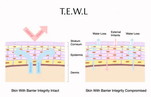 What-is-T.E.W.L-How-to-Prevent-it Skin Virtue