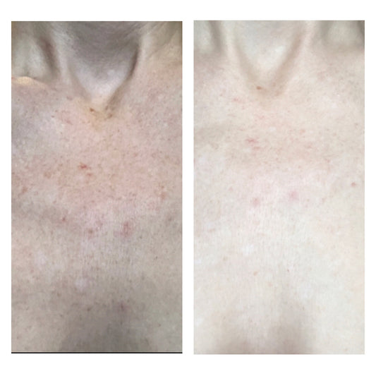 Future Advanced Brightening Nina