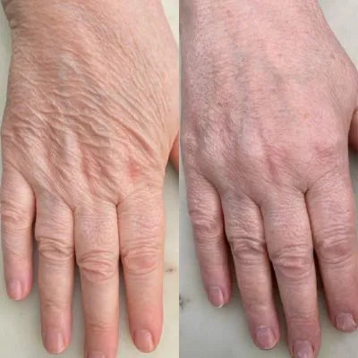 Before and after skincare result