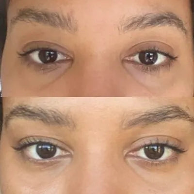 Before and after skincare result