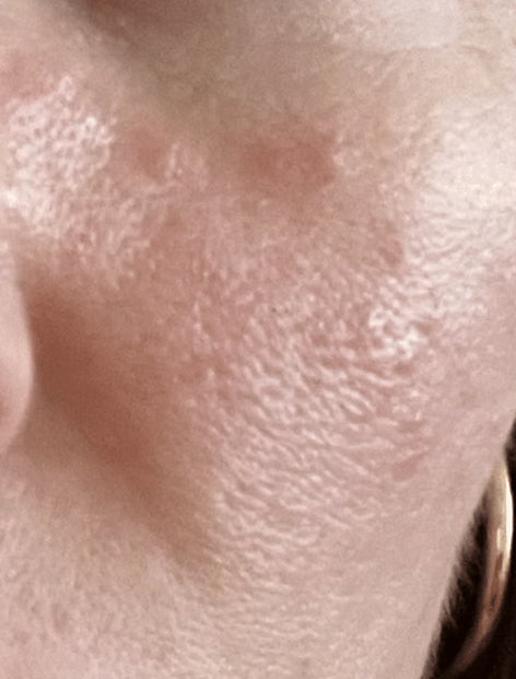 - After