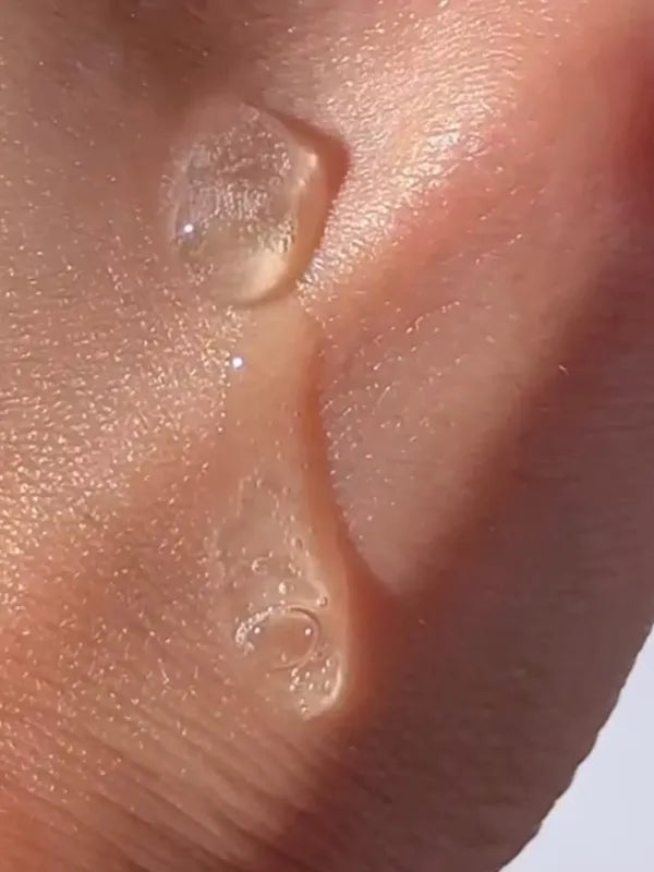 Blemishes and enlarged pores skin texture