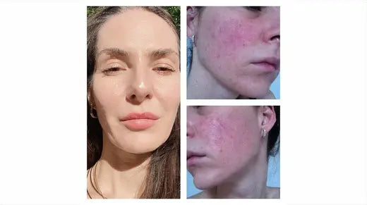 6-of-the-best-ingredients-for-sensitive-skin Skin Virtue