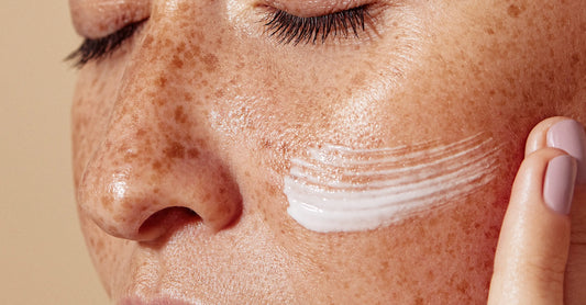 close up of combination skin model with cream smared across her cheek
