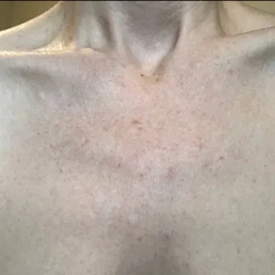 Skin Virtue before and after skincare results - image 12