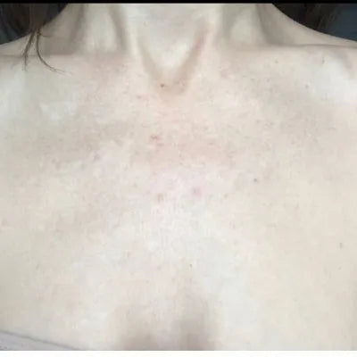 Skin Virtue before and after skincare results - image 13