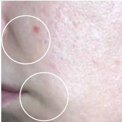 Skin Virtue before and after skincare results - image 14