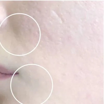 Skin Virtue before and after skincare results - image 15