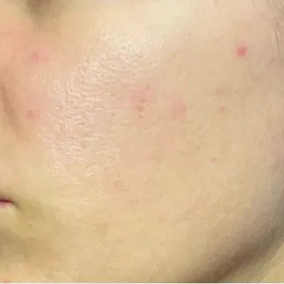 Skin Virtue before and after skincare results - image 18