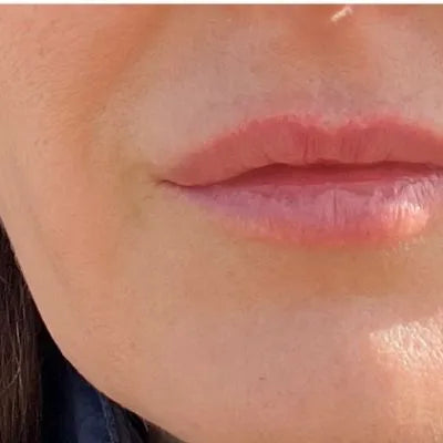 Skin Virtue before and after skincare results - image 20