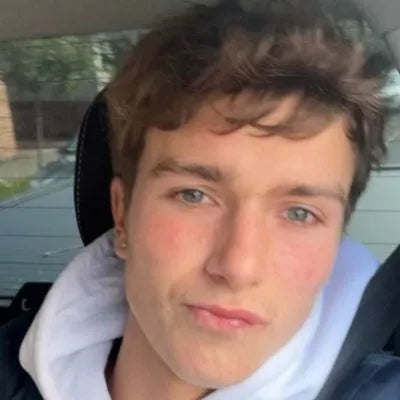 Skin Virtue before and after skincare results - image 23