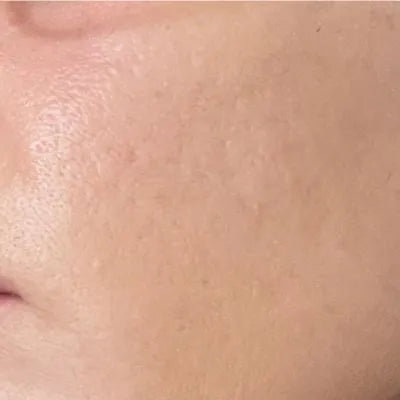 Skin Virtue before and after skincare results - image 25