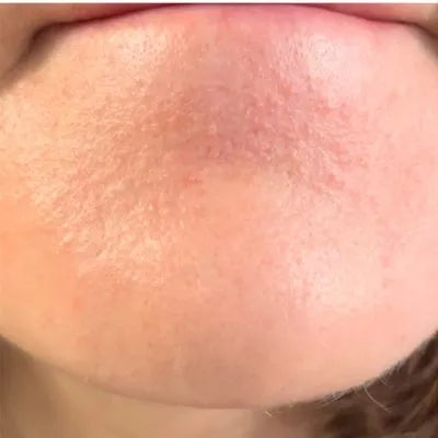 Skin Virtue before and after skincare results - image 26