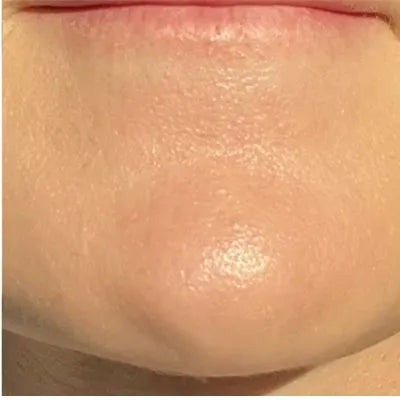 Skin Virtue before and after skincare results - image 27