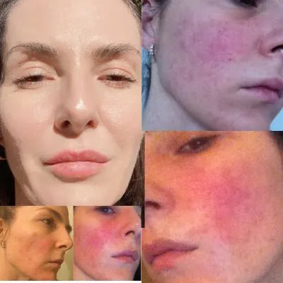 Skin Virtue before and after skincare results - image 2