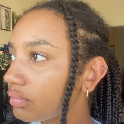 Skin Virtue before and after skincare results - image 4