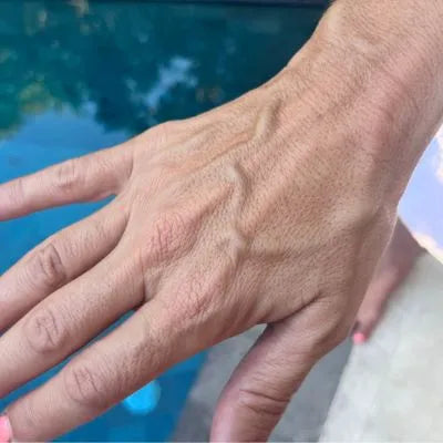 Skin Virtue before and after skincare results - image 5