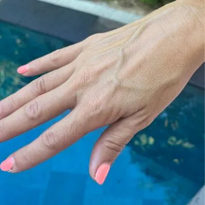 Skin Virtue before and after skincare results - image 6