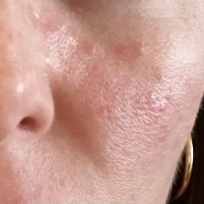 Skin Virtue before and after skincare results - image 7