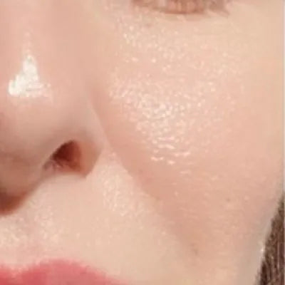 Skin Virtue before and after skincare results - image 8