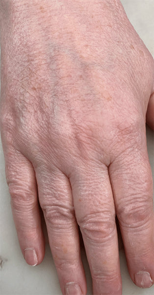 Wrinkly Hands | After